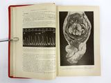 Antique 1922 Medical Obstetrics Book by Fabre, 69 Illustrations, Childbirth