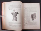 Antique Medical Book 1903, Medicology Encyclopedia, Illustrated Unfolding Plates